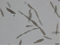 Alternaria brassicicola conidia.jpg